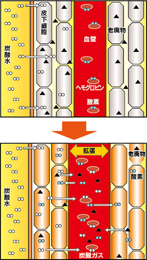 ソーダスパ図